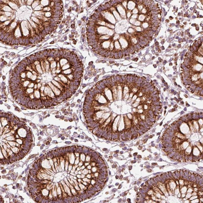 ENTPD6 Antibody in Immunohistochemistry (Paraffin) (IHC (P))