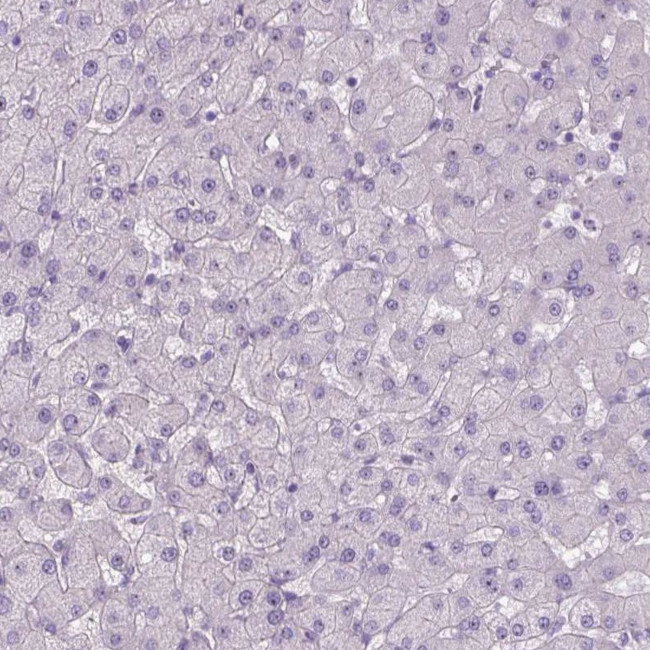 Tau Antibody in Immunohistochemistry (Paraffin) (IHC (P))