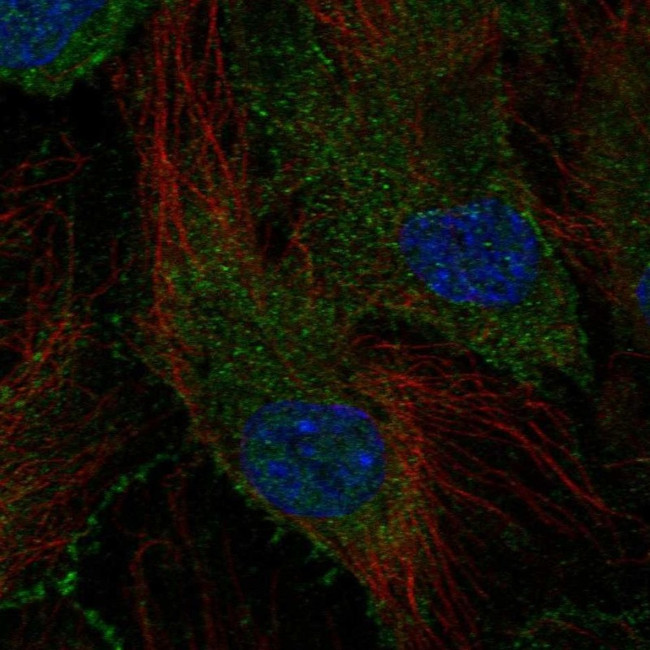 SCHIP1 Antibody in Immunocytochemistry (ICC/IF)