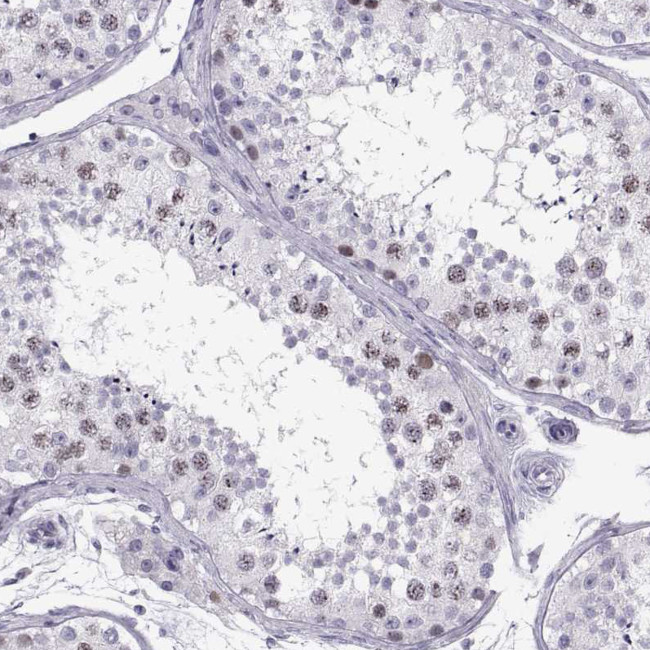 SGOL1 Antibody in Immunohistochemistry (Paraffin) (IHC (P))