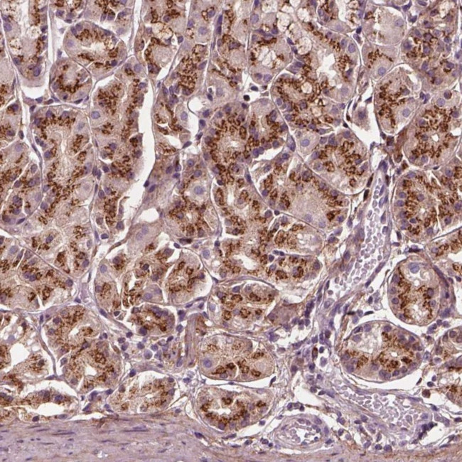 SEC23B Antibody in Immunohistochemistry (Paraffin) (IHC (P))