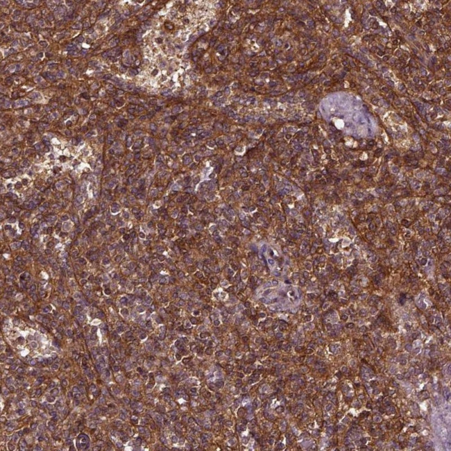 NORE1 Antibody in Immunohistochemistry (Paraffin) (IHC (P))