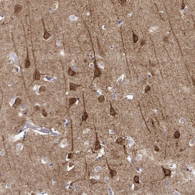 NECAB3 Antibody in Immunohistochemistry (Paraffin) (IHC (P))