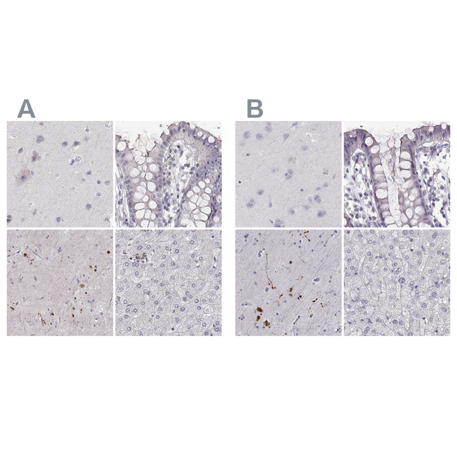 RUNDC3A Antibody in Immunohistochemistry (Paraffin) (IHC (P))