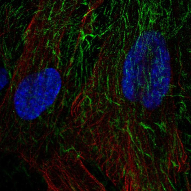 CD264 (TRAIL-R4) Antibody in Immunocytochemistry (ICC/IF)