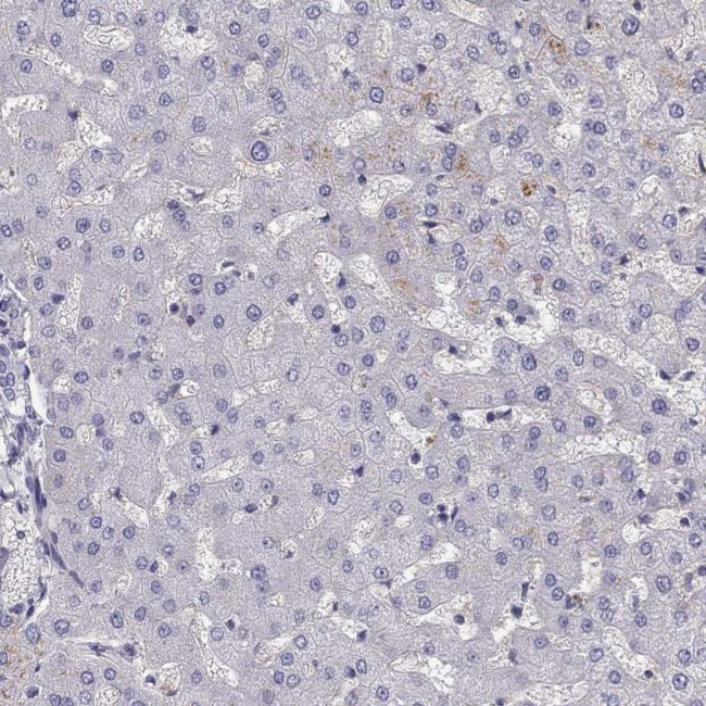 STOML3 Antibody in Immunohistochemistry (Paraffin) (IHC (P))