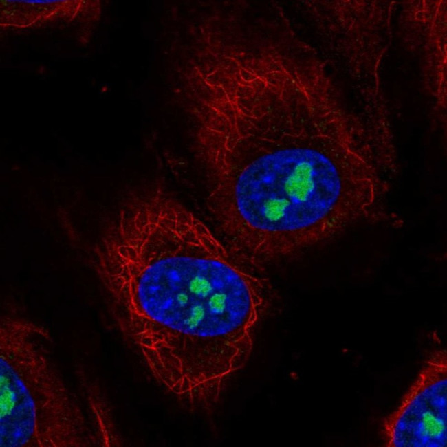 TMEM217 Antibody in Immunocytochemistry (ICC/IF)