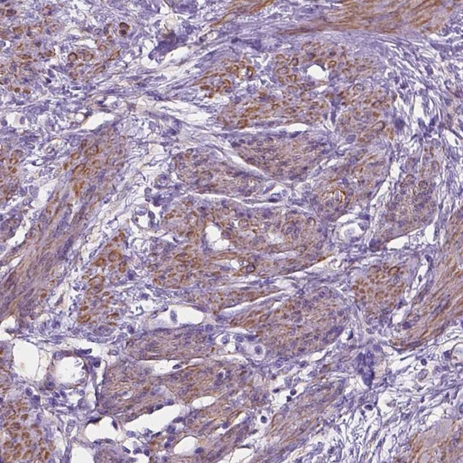 TOR2A Antibody in Immunohistochemistry (Paraffin) (IHC (P))