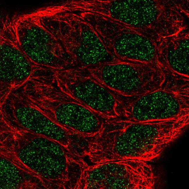 ALOX5 Antibody in Immunocytochemistry (ICC/IF)
