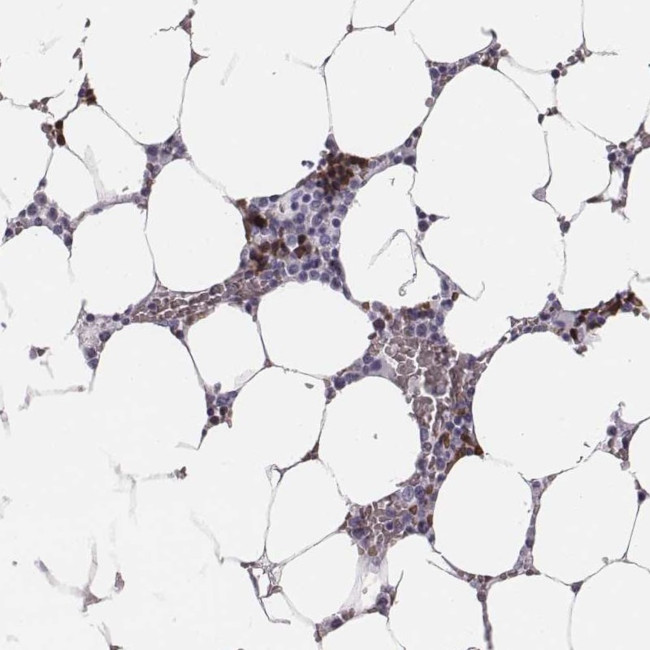 HBZ Antibody in Immunohistochemistry (Paraffin) (IHC (P))
