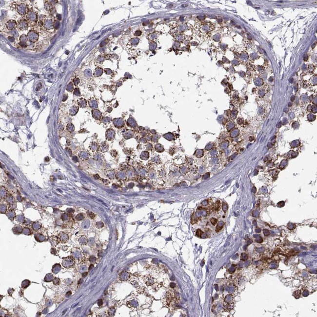 NECAB3 Antibody in Immunohistochemistry (Paraffin) (IHC (P))