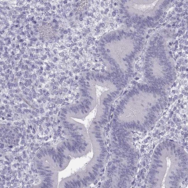 MROH7 Antibody in Immunohistochemistry (Paraffin) (IHC (P))