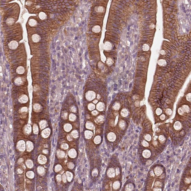 ITFG3 Antibody in Immunohistochemistry (Paraffin) (IHC (P))