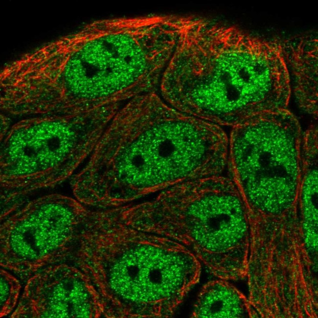 TNIP1 Antibody in Immunocytochemistry (ICC/IF)