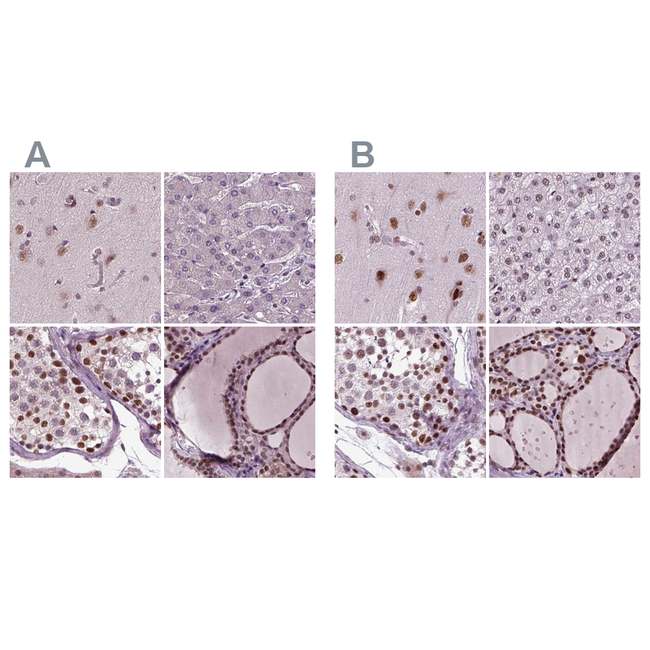 RCOR3 Antibody in Immunohistochemistry (Paraffin) (IHC (P))