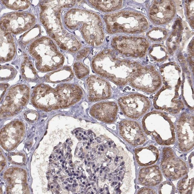 C2orf47 Antibody in Immunohistochemistry (Paraffin) (IHC (P))