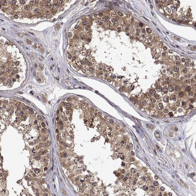 ZNRF2 Antibody in Immunohistochemistry (Paraffin) (IHC (P))