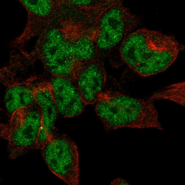 CRMP5 Antibody in Immunocytochemistry (ICC/IF)