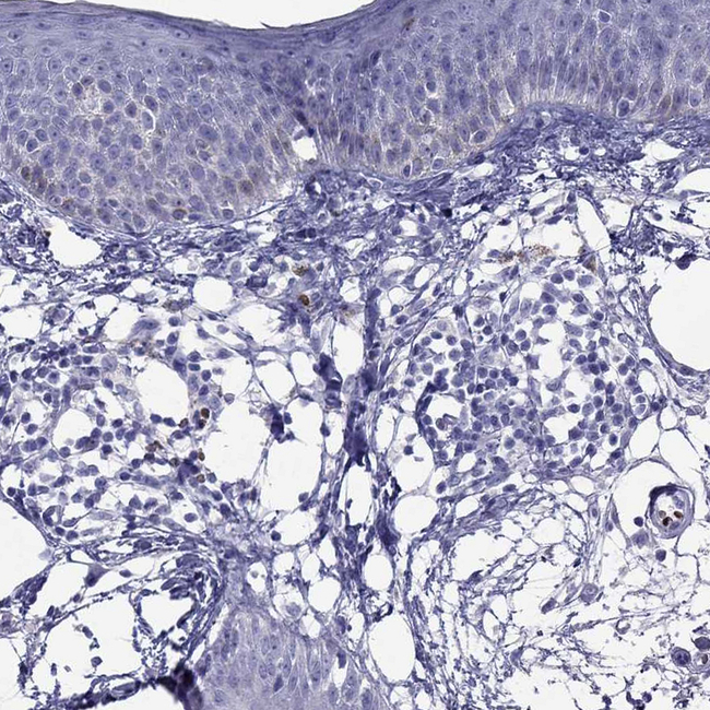 CXorf41 Antibody in Immunohistochemistry (Paraffin) (IHC (P))