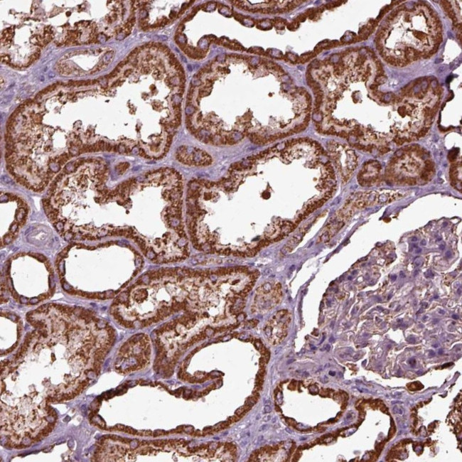 TMEM254 Antibody in Immunohistochemistry (Paraffin) (IHC (P))