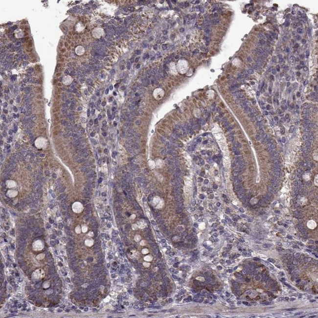 HDHD1 Antibody in Immunohistochemistry (Paraffin) (IHC (P))