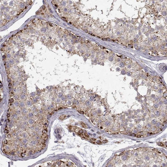 CMTM3 Antibody in Immunohistochemistry (Paraffin) (IHC (P))