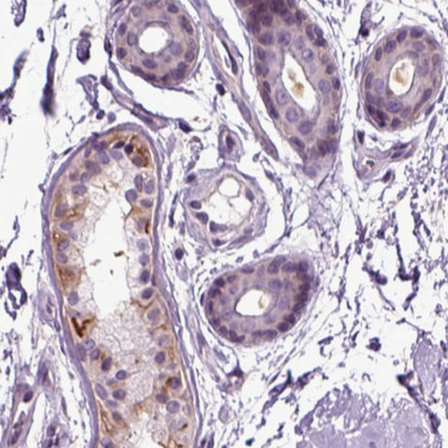 PLCH2 Antibody in Immunohistochemistry (Paraffin) (IHC (P))