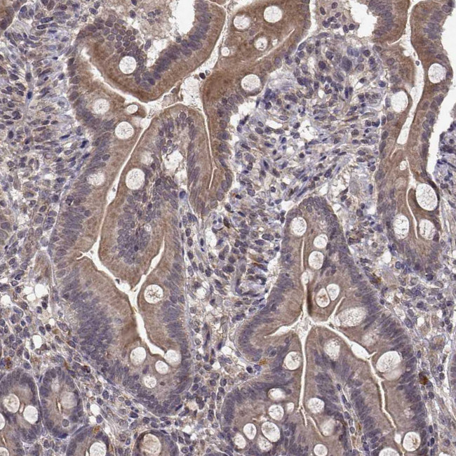 Abl2 Antibody in Immunohistochemistry (Paraffin) (IHC (P))