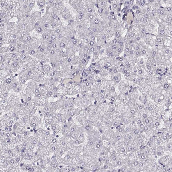 TMPRSS15 Antibody in Immunohistochemistry (Paraffin) (IHC (P))