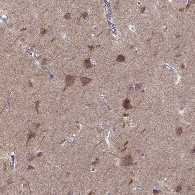 MAST1 Antibody in Immunohistochemistry (Paraffin) (IHC (P))
