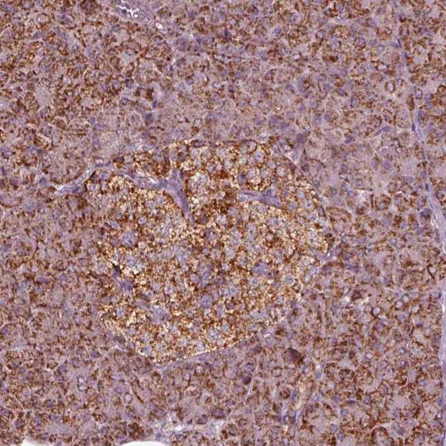 NDUFB10 Antibody in Immunohistochemistry (Paraffin) (IHC (P))