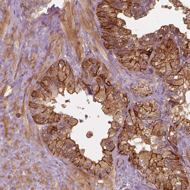 FAM107B Antibody in Immunohistochemistry (Paraffin) (IHC (P))