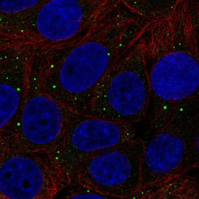 Thrombospondin 3 Antibody in Immunocytochemistry (ICC/IF)