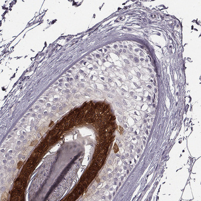 FABP9 Antibody in Immunohistochemistry (Paraffin) (IHC (P))