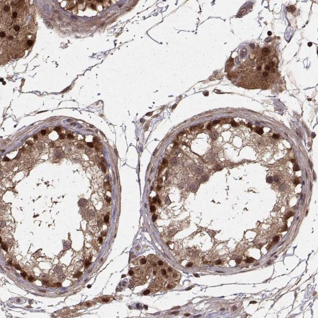 DEDD Antibody in Immunohistochemistry (Paraffin) (IHC (P))