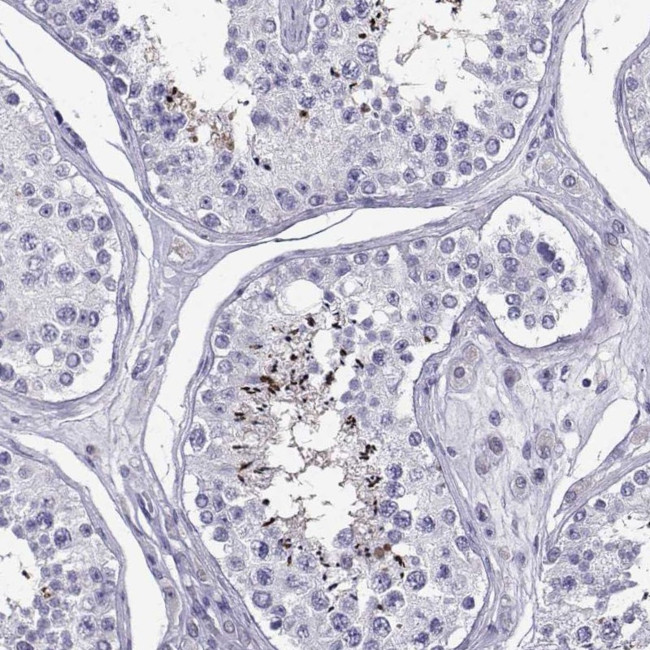 PGK2 Antibody in Immunohistochemistry (Paraffin) (IHC (P))