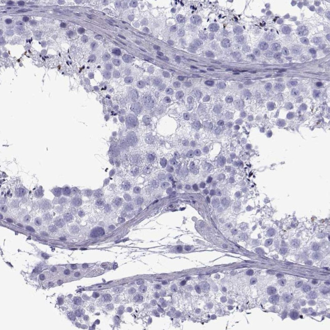 SPANXD Antibody in Immunohistochemistry (Paraffin) (IHC (P))