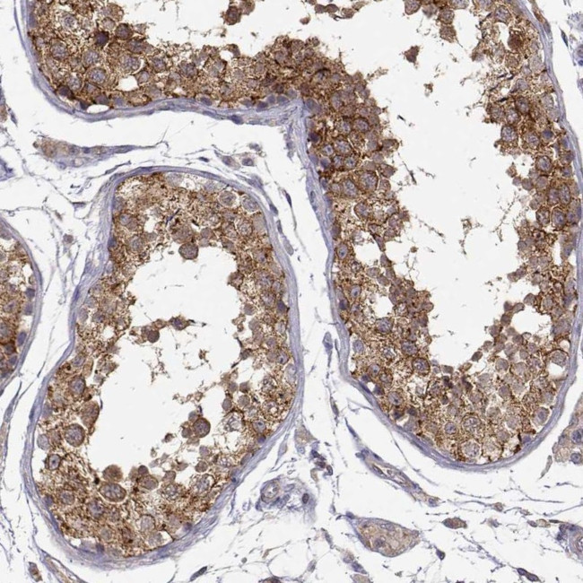 PAIP1 Antibody in Immunohistochemistry (Paraffin) (IHC (P))