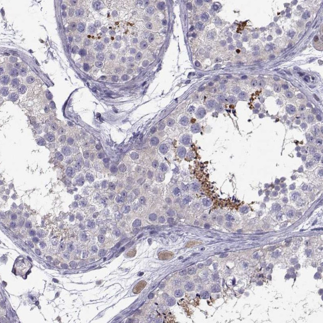 PGK2 Antibody in Immunohistochemistry (Paraffin) (IHC (P))