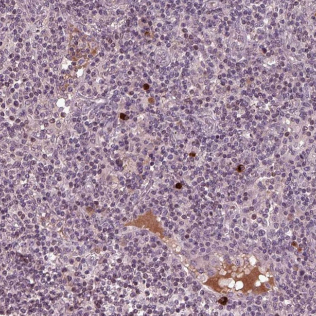 PTX4 Antibody in Immunohistochemistry (Paraffin) (IHC (P))