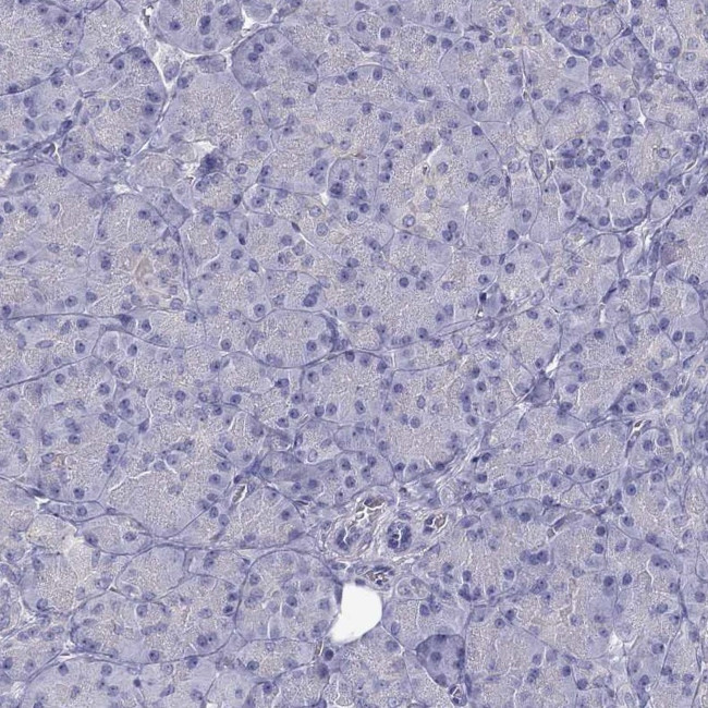 Erc2 Antibody in Immunohistochemistry (Paraffin) (IHC (P))