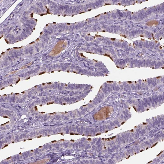 MDH1B Antibody in Immunohistochemistry (Paraffin) (IHC (P))