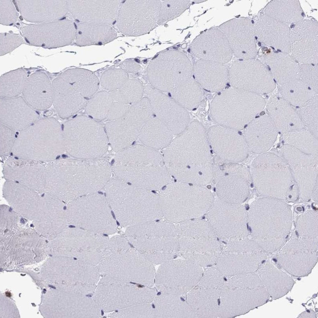 CCL27 Antibody in Immunohistochemistry (Paraffin) (IHC (P))