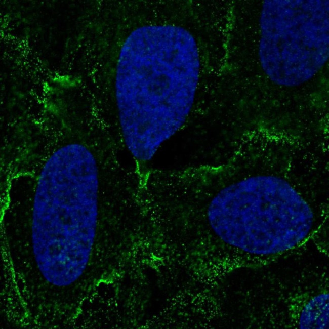 Desmocollin 3 Antibody in Immunocytochemistry (ICC/IF)
