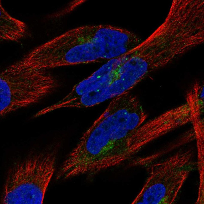 PTPN21 Antibody in Immunocytochemistry (ICC/IF)