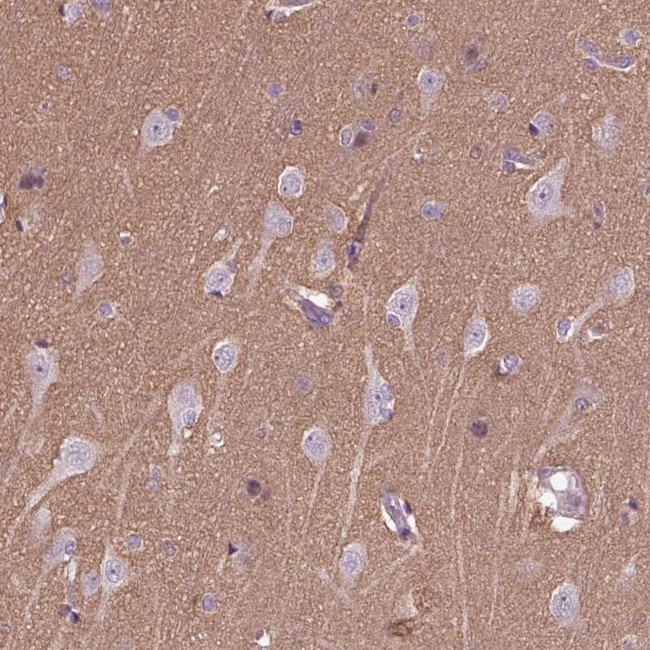 HAGHL Antibody in Immunohistochemistry (Paraffin) (IHC (P))