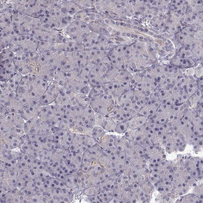 ADAM11 Antibody in Immunohistochemistry (Paraffin) (IHC (P))