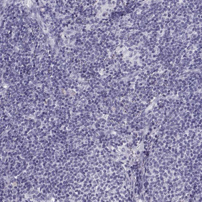 SLC22A6 Antibody in Immunohistochemistry (Paraffin) (IHC (P))