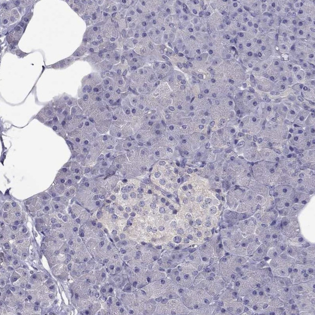 LRRC46 Antibody in Immunohistochemistry (Paraffin) (IHC (P))