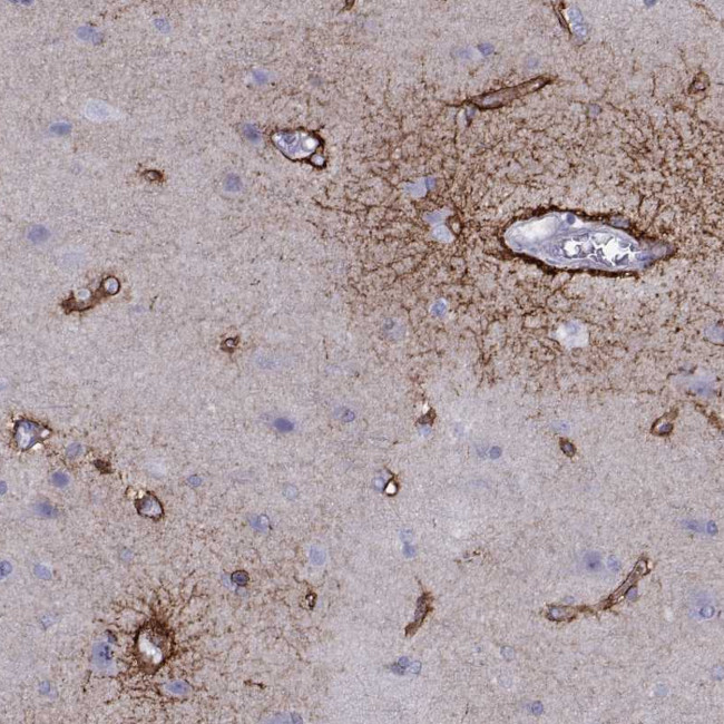 TMEM158 Antibody in Immunohistochemistry (Paraffin) (IHC (P))